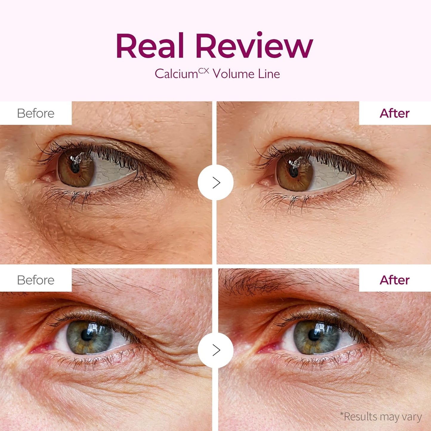 Calcium Volume under Eye Patches for Puffy Eyes & Dark Circles, Hydrogel Eye Mask for Wrinkles, Fine Lines & Sagging Skin, Firming Collagen Eye Patch, Korean Skin Care (60 Count)